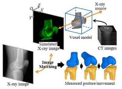 動態解析技術：CT画像を基にコンピュータ上で作成した擬似X線画像をX線画像内の骨の像に重ね合わせることで、生体内での関節の姿勢や動きを計測する技術